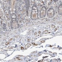 Anti-ADAMTSL3 antibody produced in rabbit 