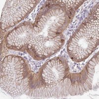 Anti-ADAT3 antibody produced in rabbit