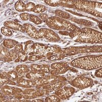 Anti-ADCY4 antibody produced in rabbit 