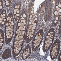 Anti-ADCY9 antibody produced in rabbit 