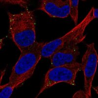 Anti-ADCYAP1R1 antibody produced in rabbit 
