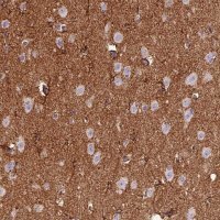 Anti-ADD3 antibody produced in rabbit 