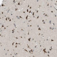 Anti-ADGRF2 antibody produced in rabbit 