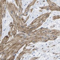 Anti-ADGRG6 antibody produced in rabbit 