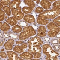 Anti-ADH5 antibody produced in rabbit 