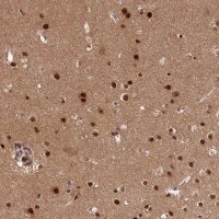 Anti-ADIG antibody produced in rabbit 