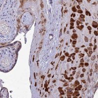 Anti-ADIPOR2 antibody produced in rabbit 
