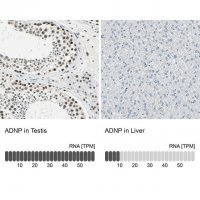 Anti-ADNP antibody produced in rabbit 