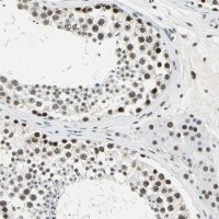 Anti-ADNP antibody produced in rabbit 