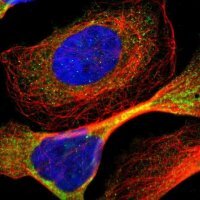 Anti-ADNP2 antibody produced in rabbit 