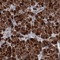 Anti-ADRB2 antibody produced in rabbit 