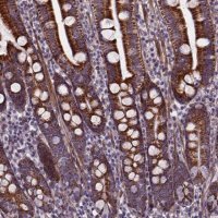 Anti-AEBP1 antibody produced in rabbit 