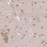 Anti-AF165138.7 antibody produced in rabbit 