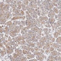 Anti-AFDN antibody produced in rabbit 