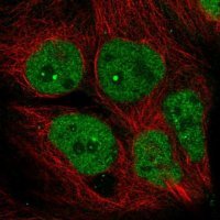 Anti-AFF4 antibody produced in rabbit HPA029634-100UL