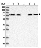 Anti-AFP antibody produced in rabbit HPA023600-100UL