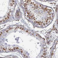 Anti-AGAP1 antibody produced in rabbit 