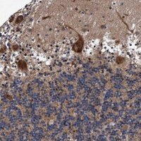 Anti-AGAP2 antibody produced in rabbit 