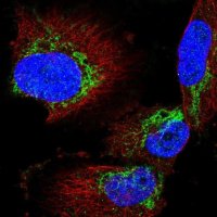 Anti-AGK antibody produced in rabbit 