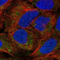 Anti-AGPAT1 antibody produced in rabbit 