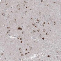 Anti-AGPS antibody produced in rabbit 