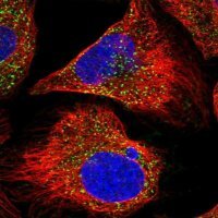 Anti-AGPS antibody produced in rabbit 