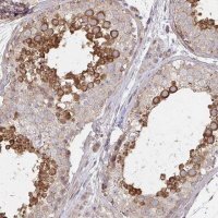 Anti-AGTPBP1 antibody produced in rabbit 