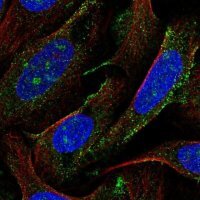 Anti-AGTPBP1 antibody produced in rabbit 