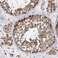 Anti-AHCTF1 antibody produced in rabbit 