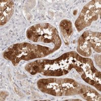 Anti-AHDC1 antibody produced in rabbit 