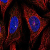 Anti-AHI1 antibody produced in rabbit 