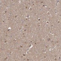 Anti-AHR antibody produced in rabbit 