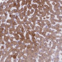 Anti-AIG1 antibody produced in rabbit 