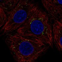 Anti-AIG1 antibody produced in rabbit 