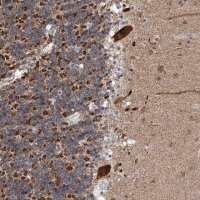 Anti-AIM1L antibody produced in rabbit 