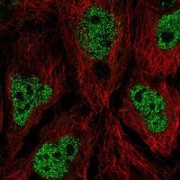Anti-AIM1L antibody produced in rabbit 