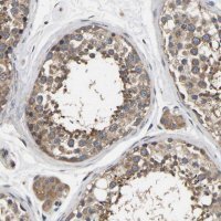 Anti-AIMP2 antibody produced in rabbit 