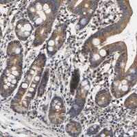 Anti-AIMP2 antibody produced in rabbit 