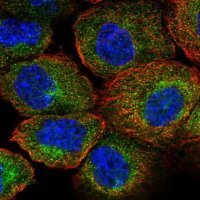 Anti-AIP antibody produced in rabbit 