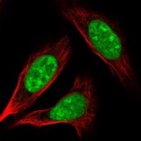 Anti-AK6 antibody produced in rabbit 