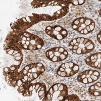Anti-AK8 antibody produced in rabbit 