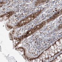 Anti-AK9 antibody produced in rabbit 