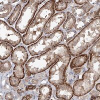 Anti-AKAP10 antibody produced in rabbit 