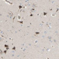 Anti-AKAP13 antibody produced in rabbit 