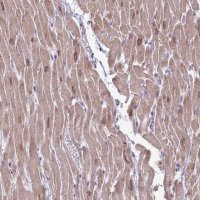 Anti-AKAP6 antibody produced in rabbit 
