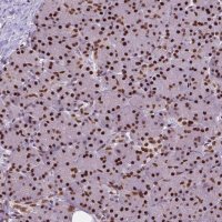 Anti-AKAP8 antibody produced in rabbit 