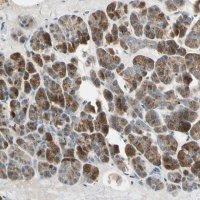 Anti-AKAP9 antibody produced in rabbit 