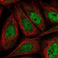 Anti-AKIP1 antibody produced in rabbit 