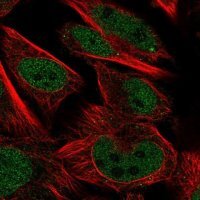 Anti-AKIRIN1 antibody produced in rabbit 