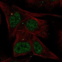 Anti-AKNA antibody produced in rabbit 